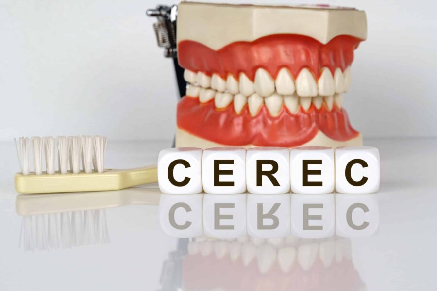 CEREC Same-Day Crowns Nashville