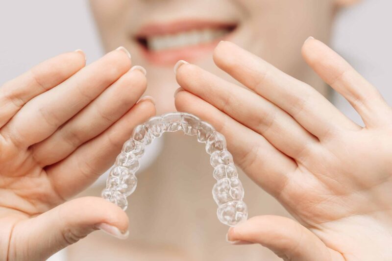 Clear Aligners Nashville